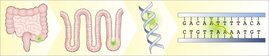 Escherichia coli-Bakterien nisten sich in Einstülpungen des Darmepithels ein. Sie geben einen Giftstoff in die Epithelzellen ab, der an die DNA-Stränge der Zellen bindet und sie miteinander verknüpft.