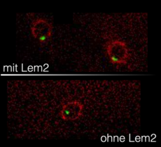  Zellkernmembran und RNA-Moleküle Abbau