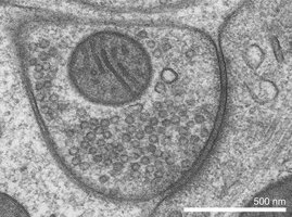 elektronenmikroskopische Aufnahme einer hemmenden Synapse