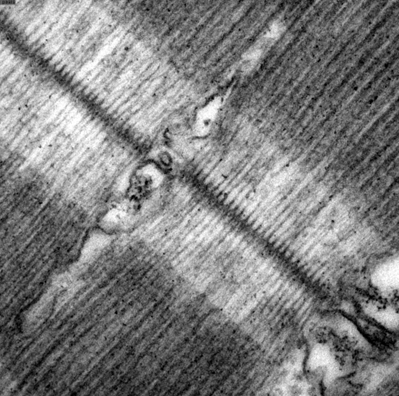 Myosin