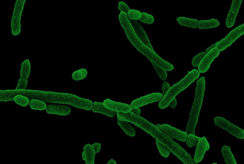 Elektronenmikroskopische Aufnahme von Segatella copri 